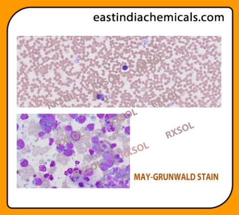 MAY-GRUNWALD STAIN