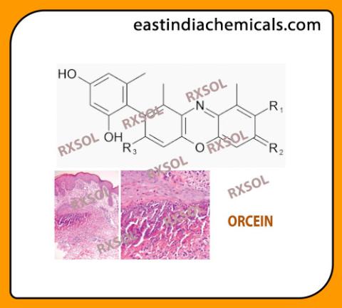 ORCEIN